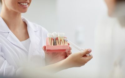 Are Dental Implants the Long-Term Treatment for Missing Teeth?
