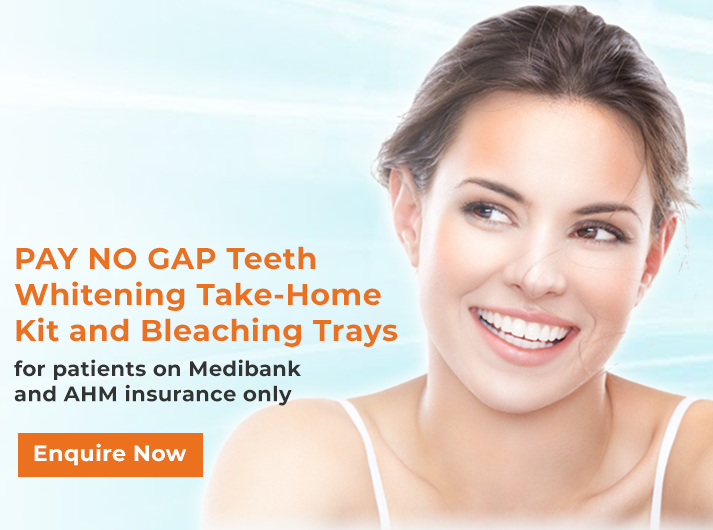 pay-no-gap-teeth-whitening-banner-campbelltown