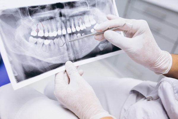 dental x-rays blurb campbelltown