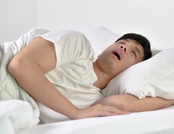 symptoms of sleep apnoea campbelltown